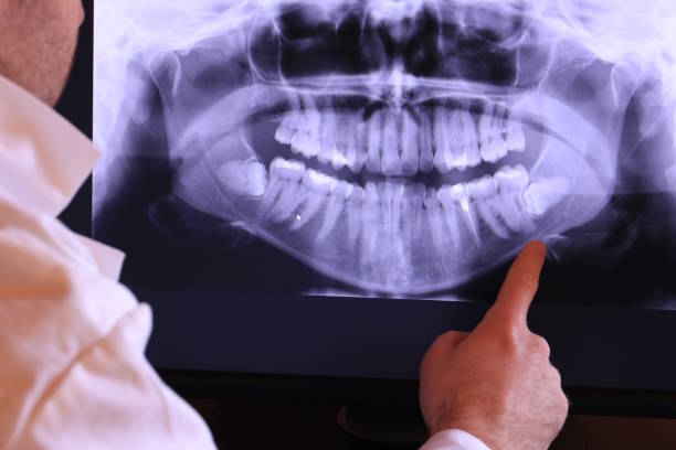 Best Orthodontic Emergency Dentist in St Joseph, MO