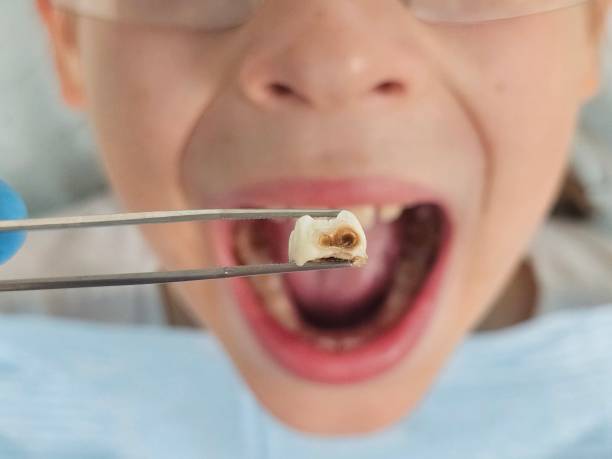 Best Mobile Emergency Dentist in St Joseph, MO
